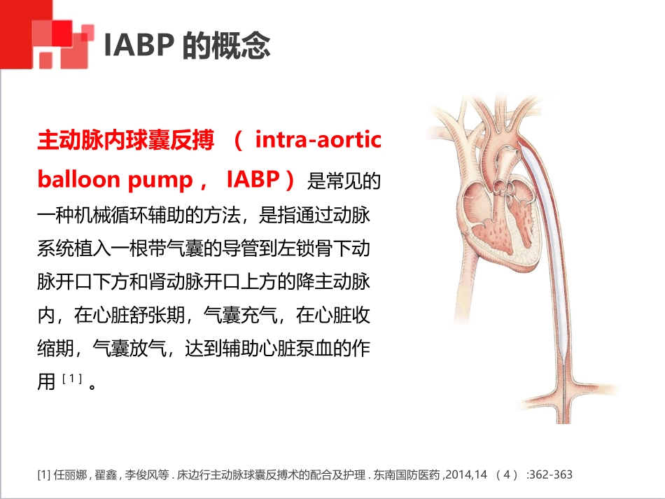主动脉球囊反搏术(IABP)监测及护理_第3页