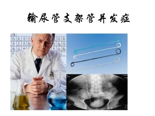 输尿管支架管并发症