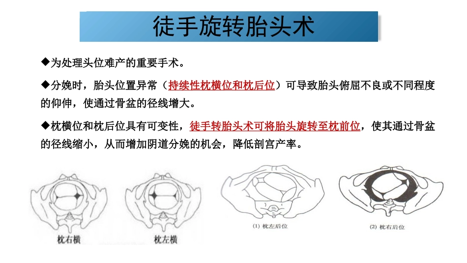 徒手旋转胎方位_第2页