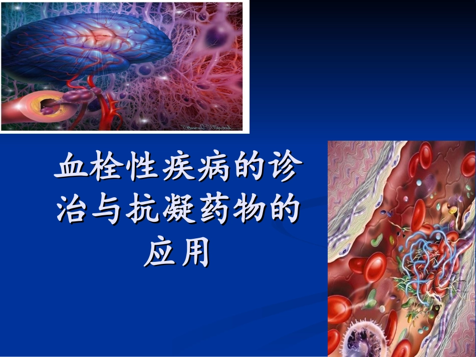 血栓性疾病的诊治与抗凝药物的应用_第1页