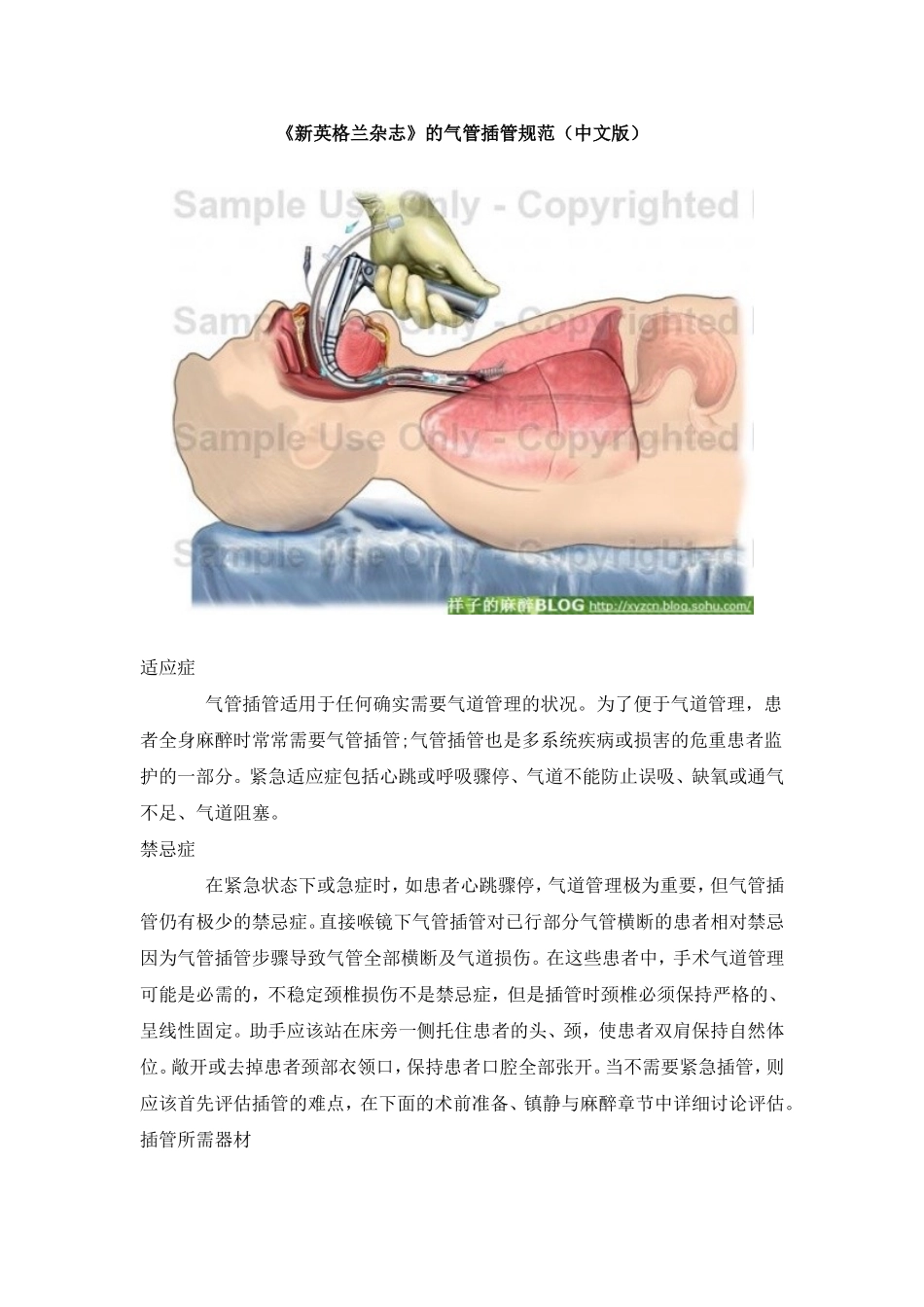 新英格兰杂志的气管插管规范中文版_第1页