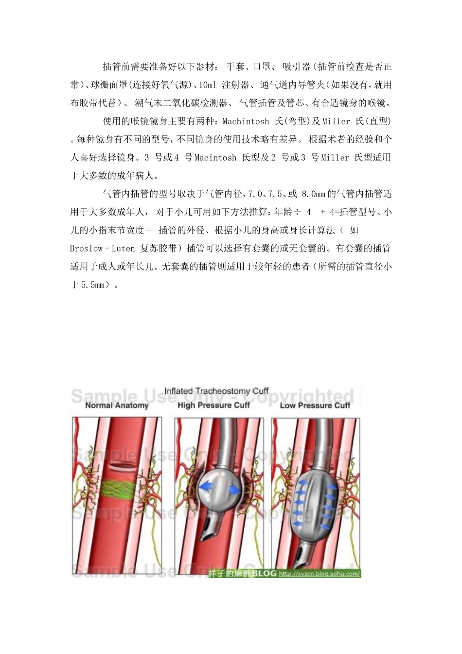 新英格兰杂志的气管插管规范中文版_第2页