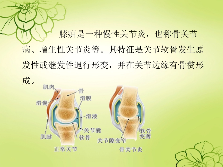 膝痹病中医护理方案_第2页