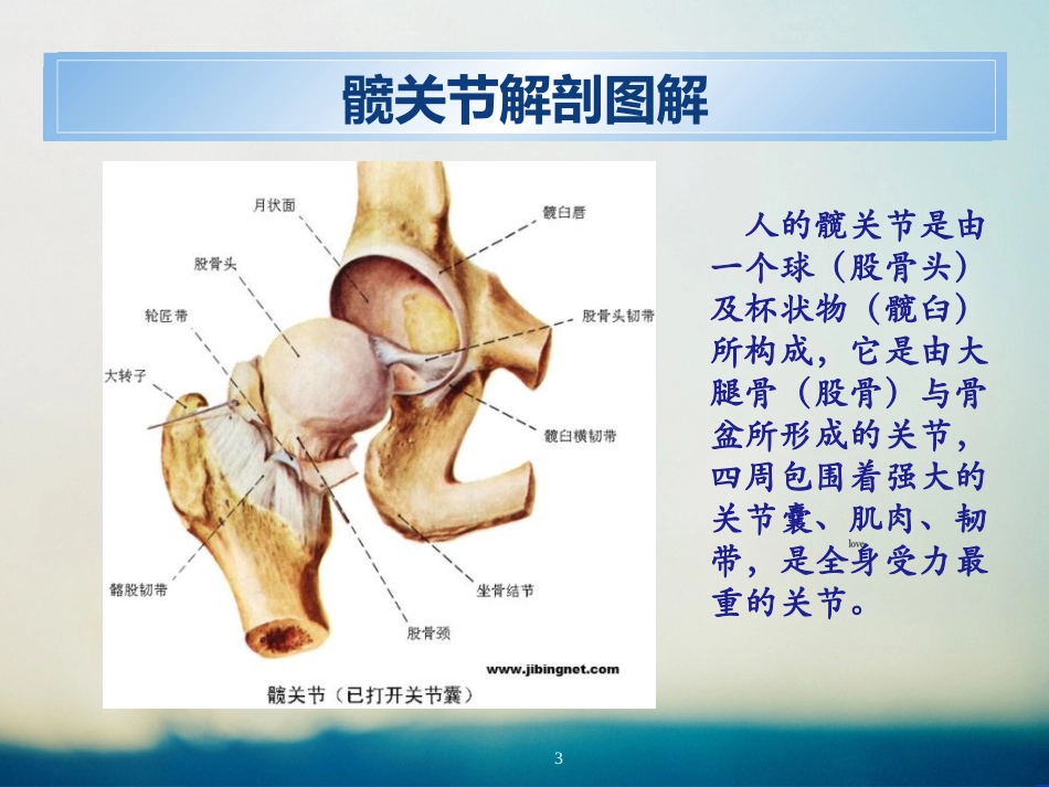 人工髋关节置换术_第3页