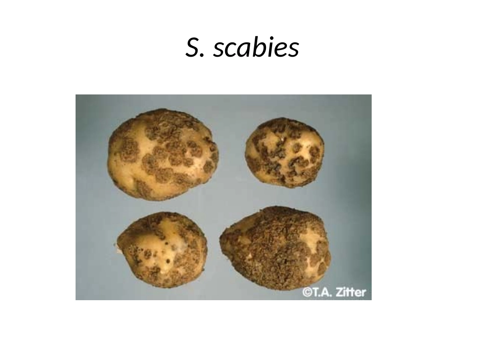 放线菌与抗生素_第2页