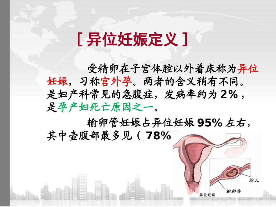 异位妊娠护理查房_第2页