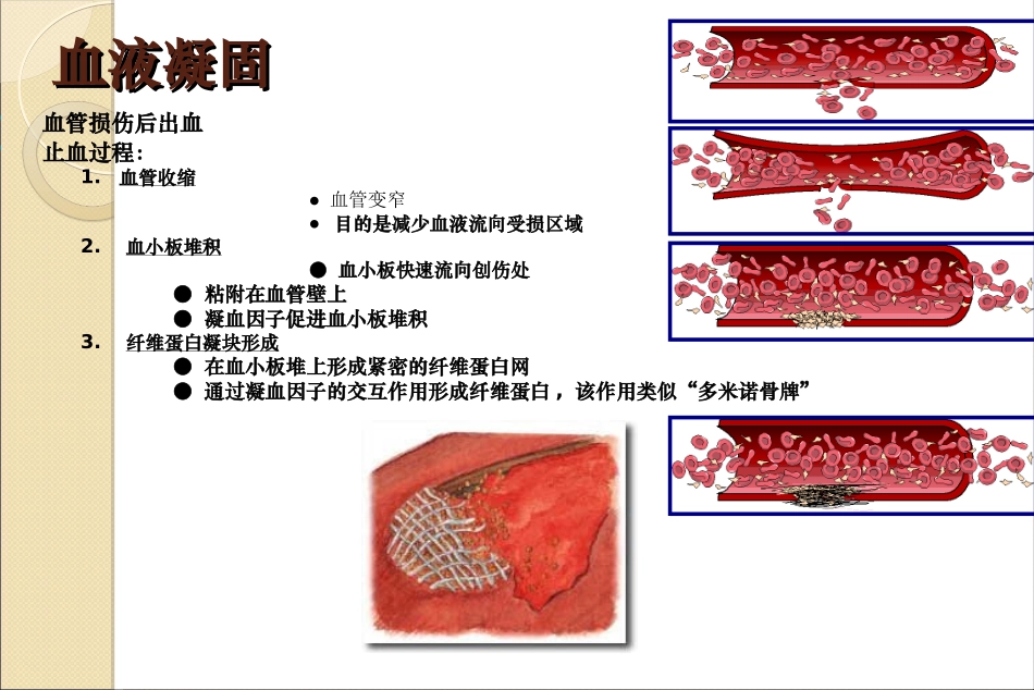 血小板GPIIbIIIa受体拮抗剂_第3页