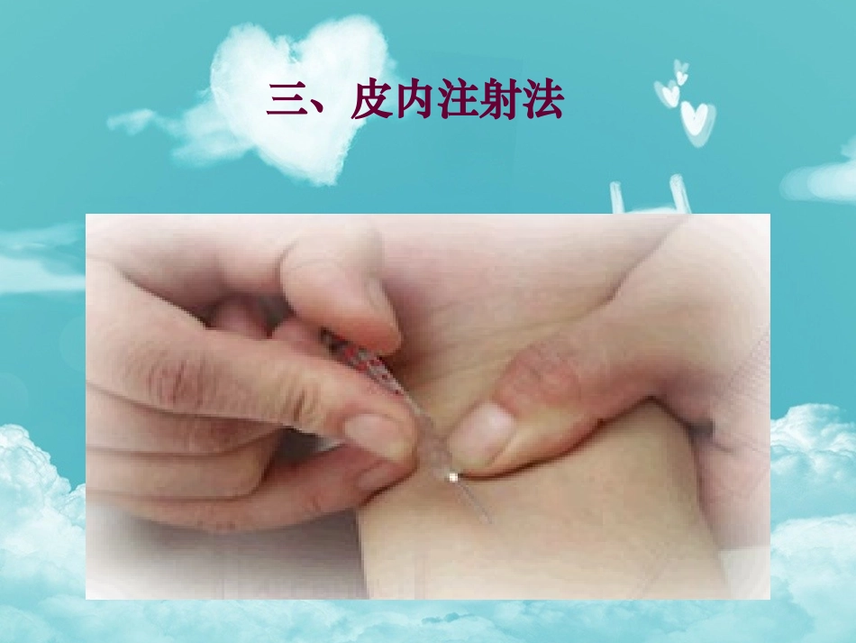皮内注射PPT课件_第2页
