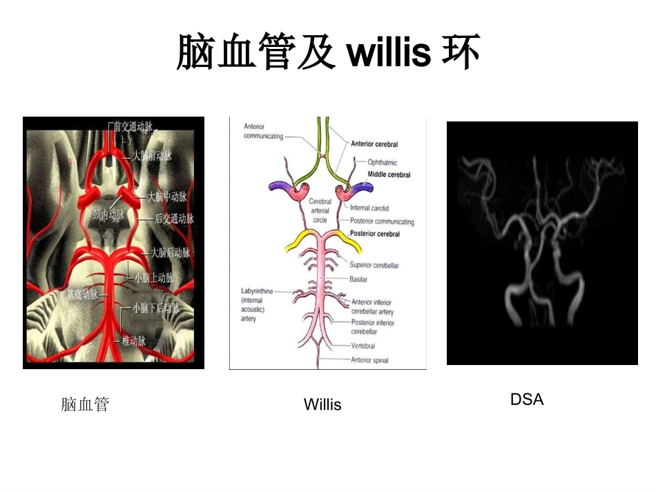 脑卒中防治知识_第3页