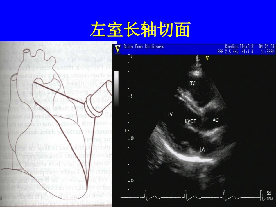 心脏超声标准切面及测量_第2页