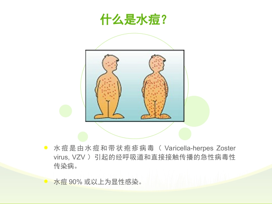 水痘防治ppt_第2页