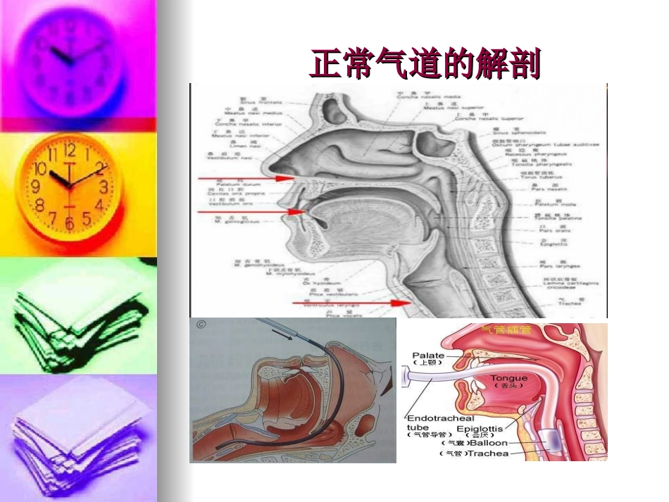 人工气道的建立和简易呼吸囊的应用技术_第2页