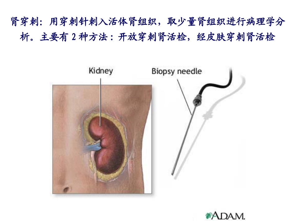 肾穿刺活检最新版_第2页