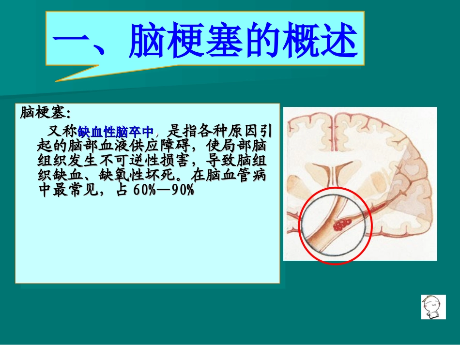 脑梗塞病人的护理查房_第3页