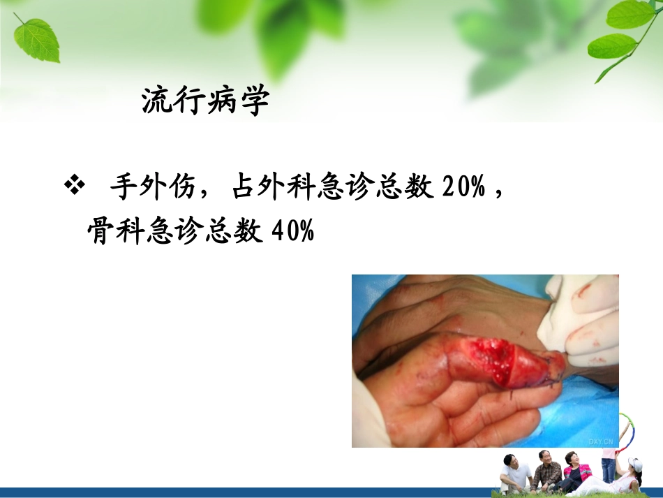 手外伤(确定版)_第2页