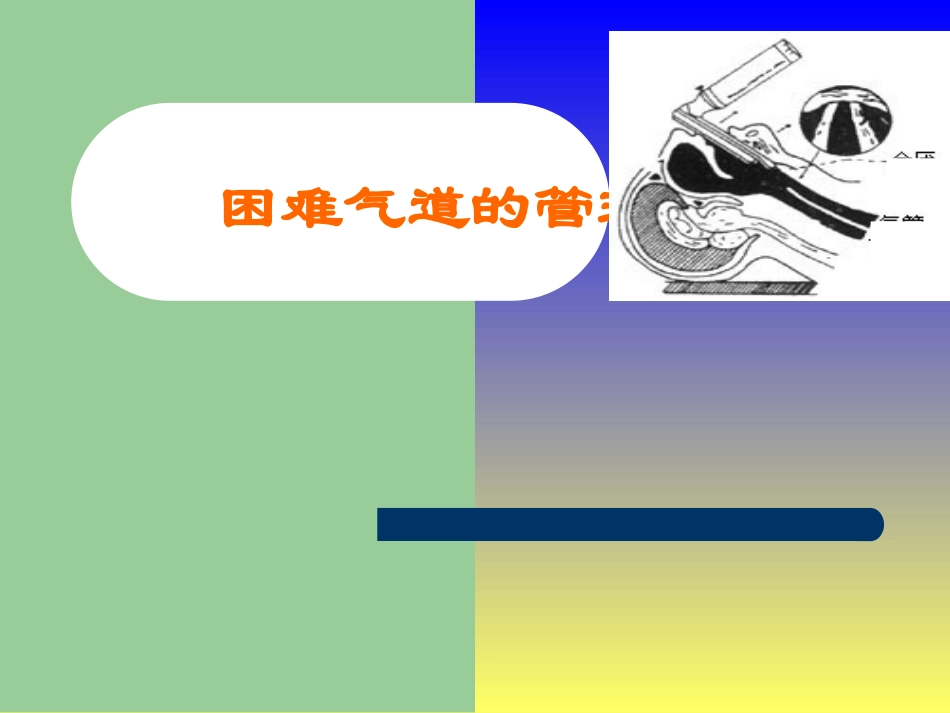 困难气道的管理_第1页