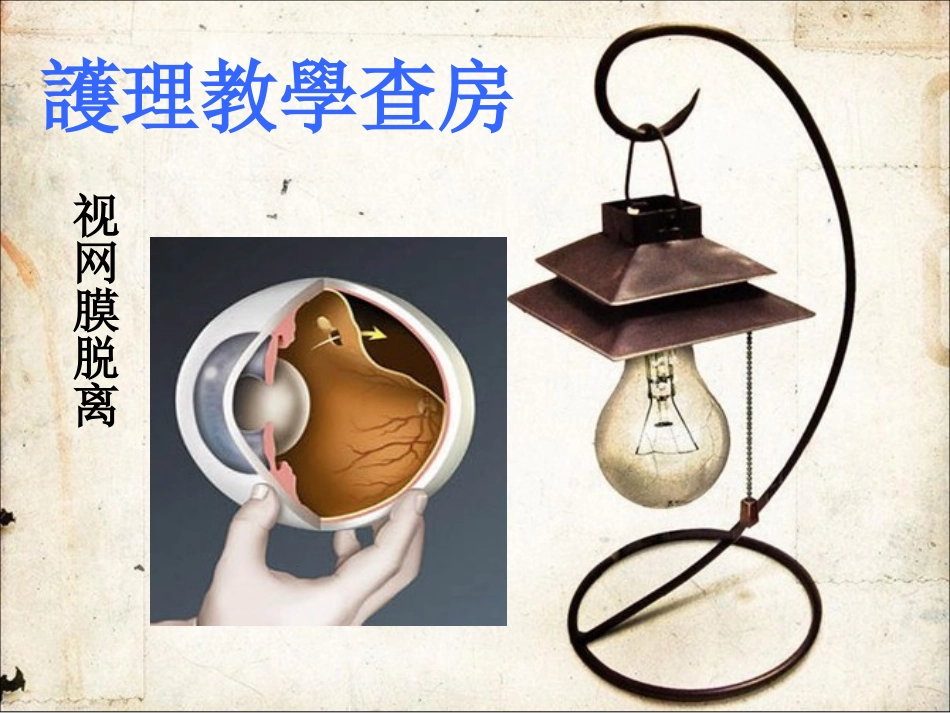 教学查房(视网膜脱离)_第1页