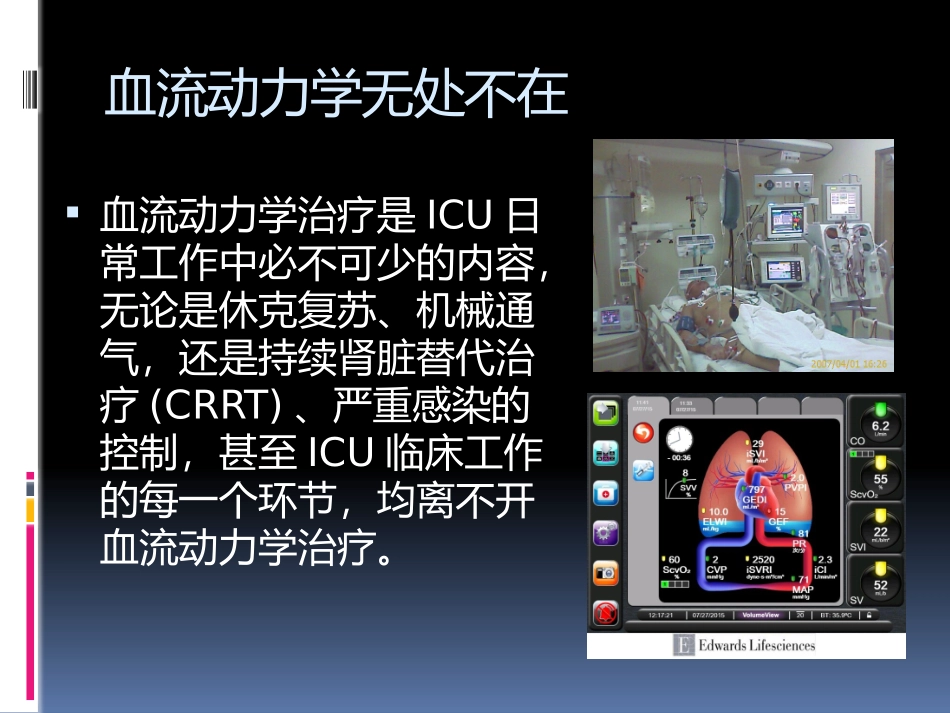 血流动力学基础解读_第2页
