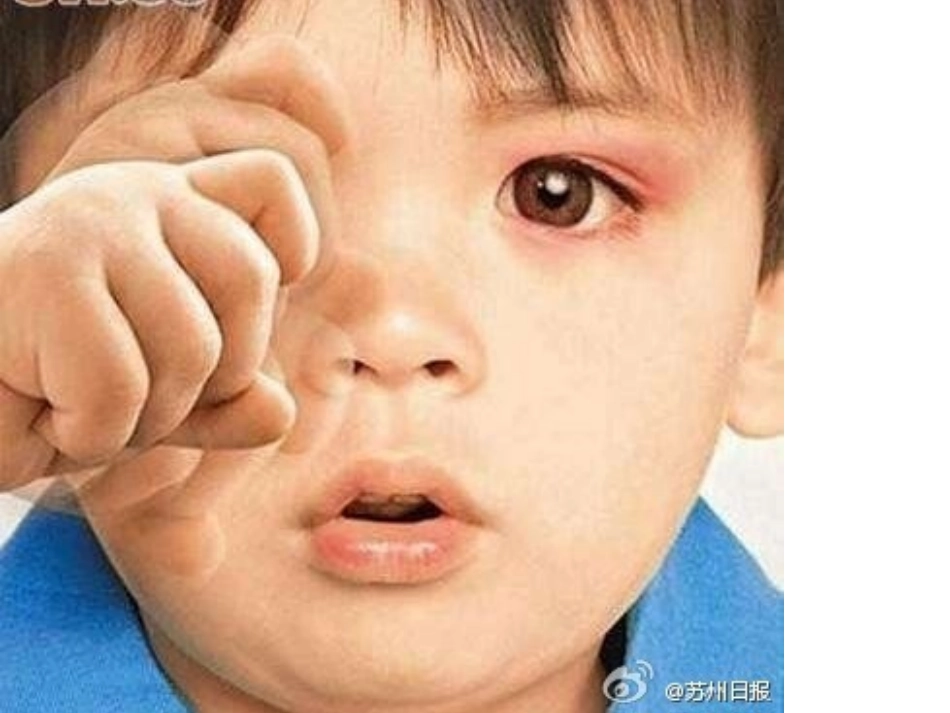 安全《不要用手揉眼睛》_第2页