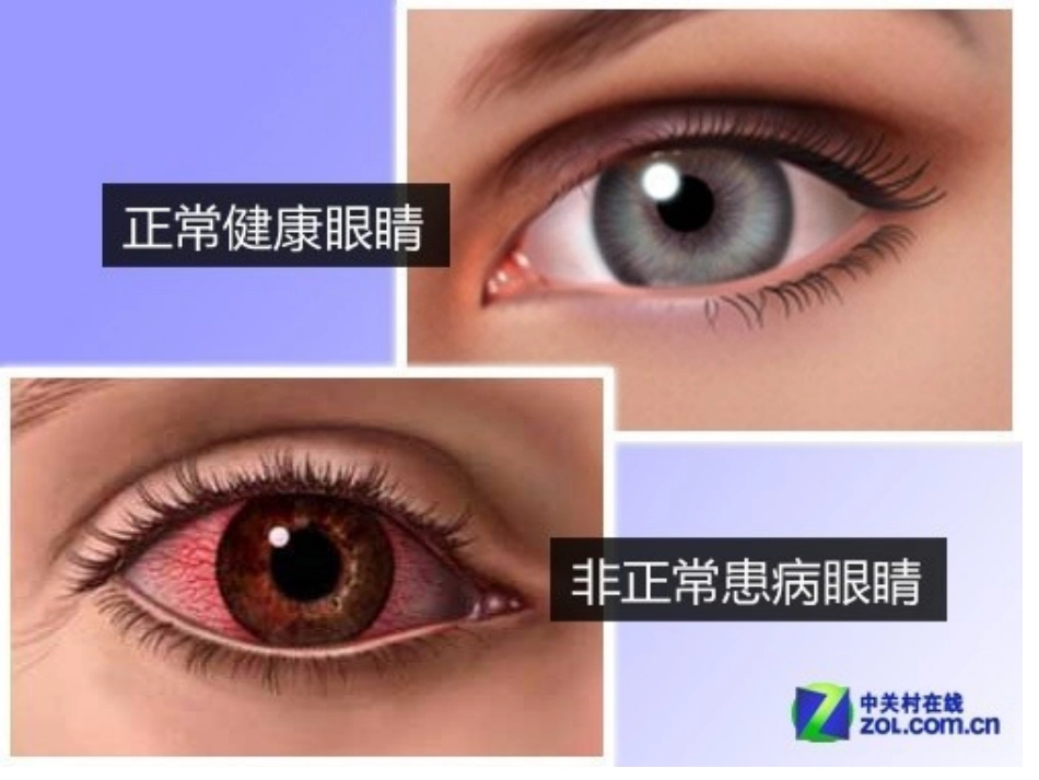 安全《不要用手揉眼睛》_第3页