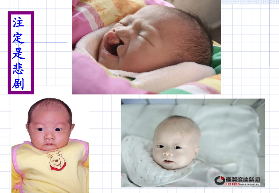 人类遗传病课件)_第2页