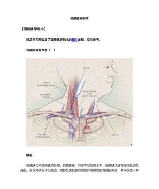 2025年颈内静脉穿刺术