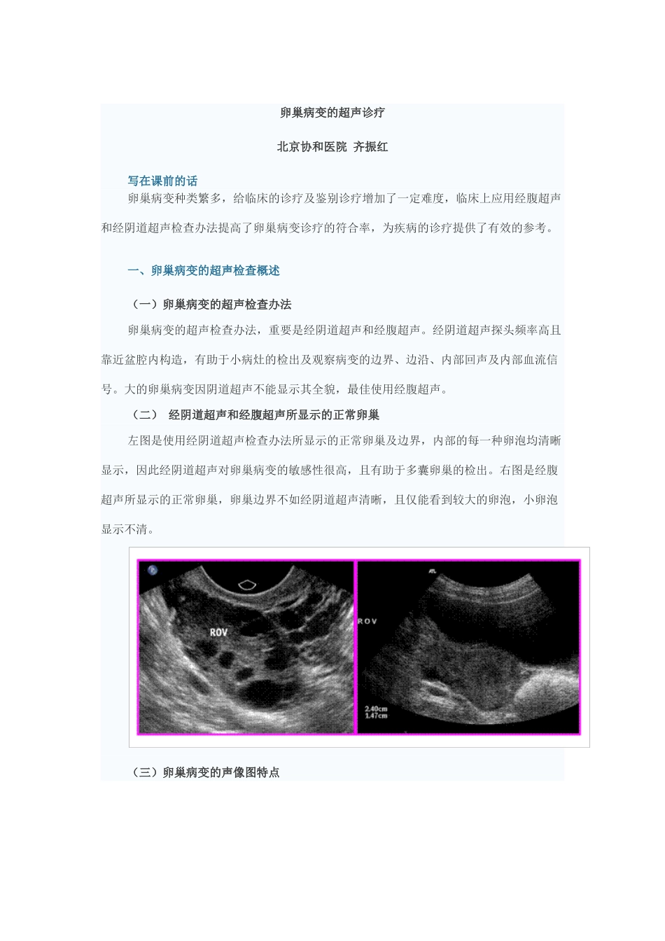 2025年卵巢病变超声诊断实习_第1页