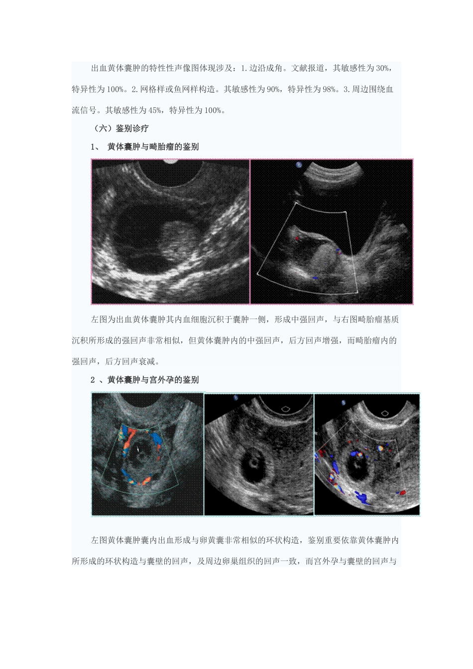 2025年卵巢病变超声诊断实习_第3页