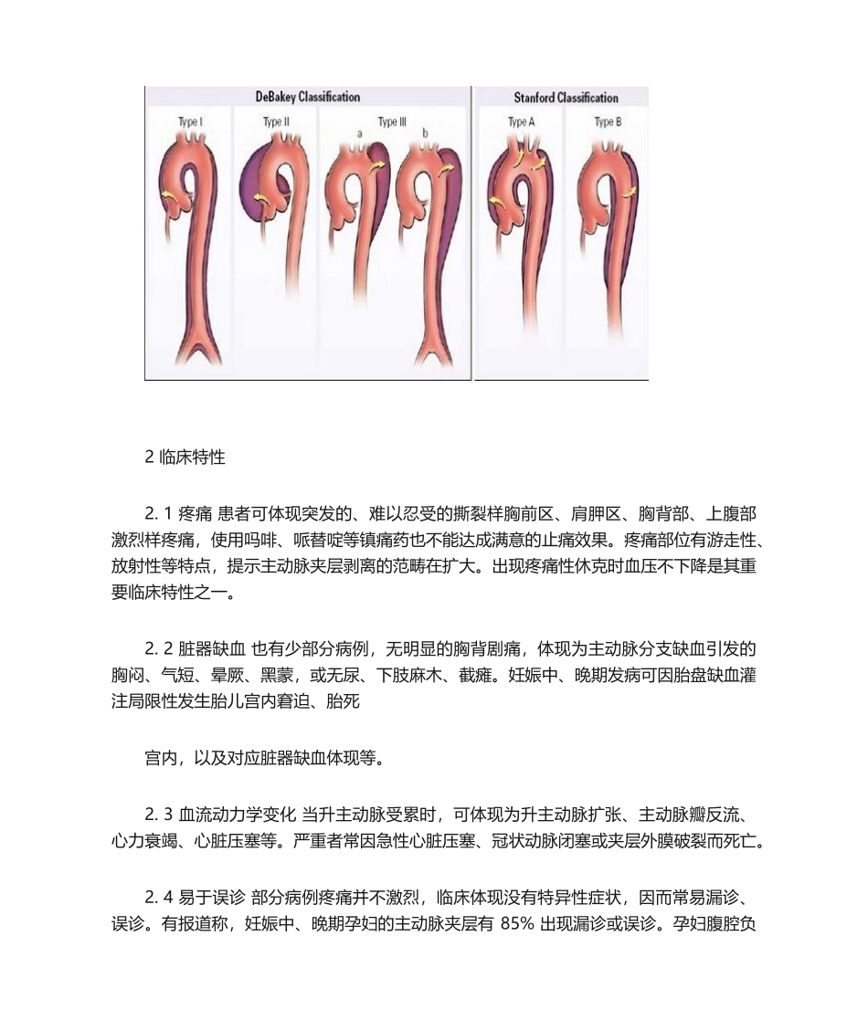 2025年妊娠合并主动脉夹层_第2页