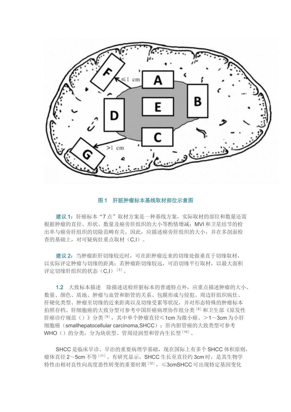 2025年原发性肝癌规范化病理诊断指导_第3页