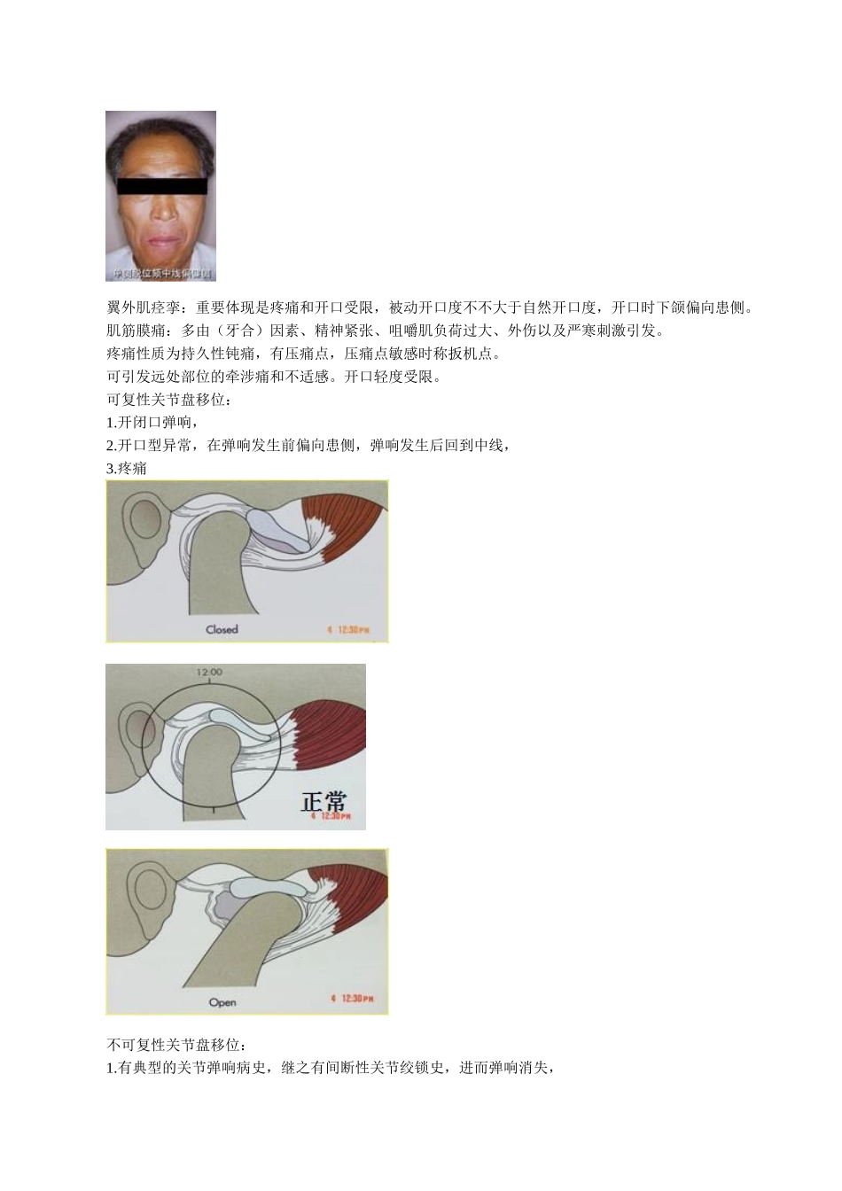 2025年口腔医师颞下颌关节疾病讲义_第2页