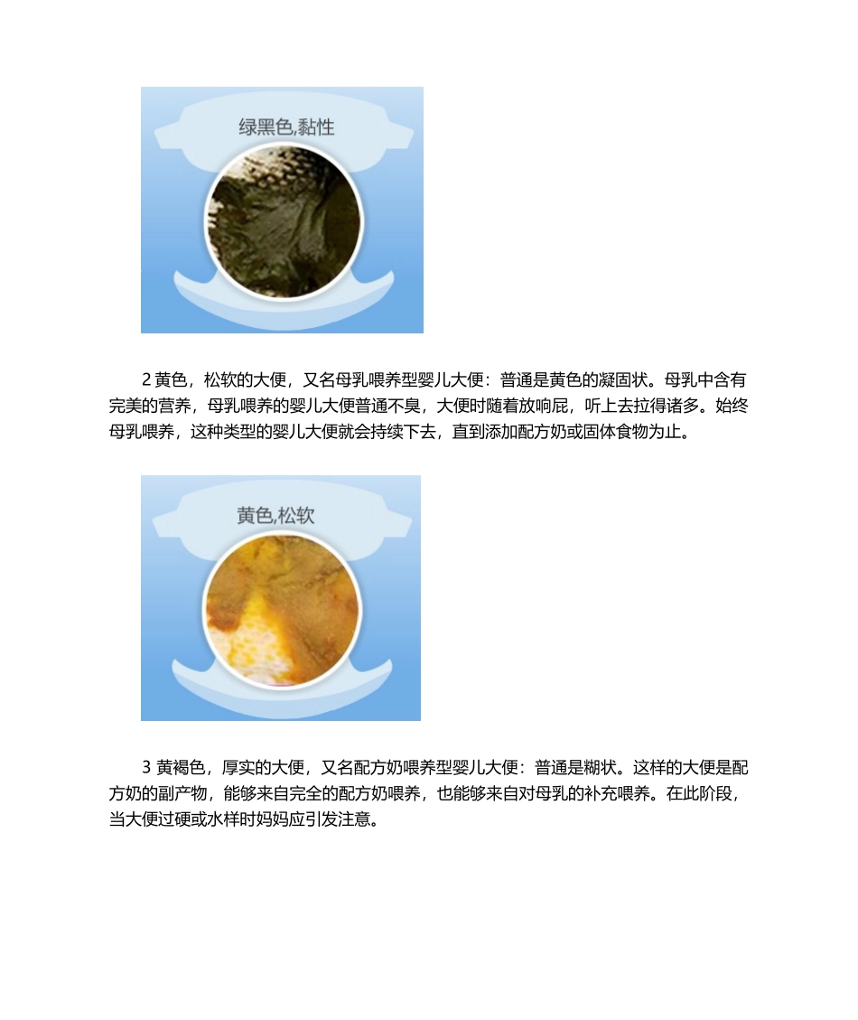 2025年婴儿大便典型颜色性状图解_第2页