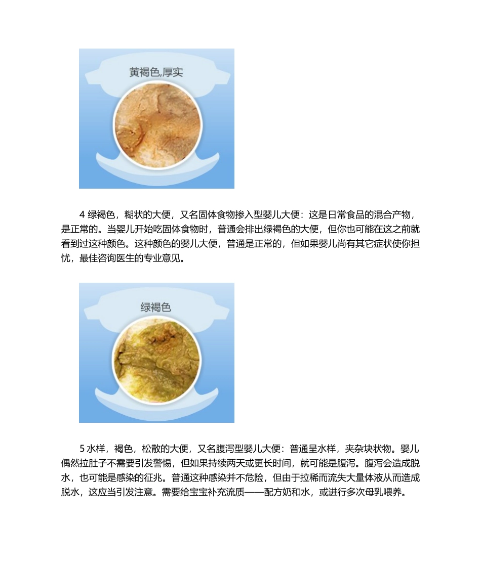 2025年婴儿大便典型颜色性状图解_第3页