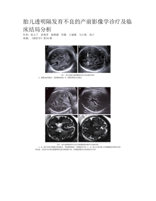 2025年胎儿透明隔发育不良的产前影像学诊断及临床结局分析