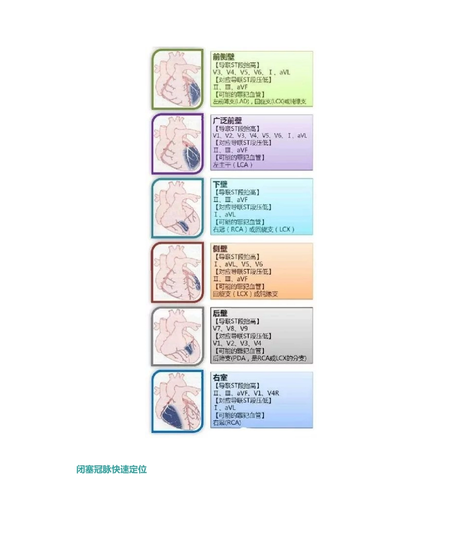 2025年心电图导联如何定位心梗_第3页