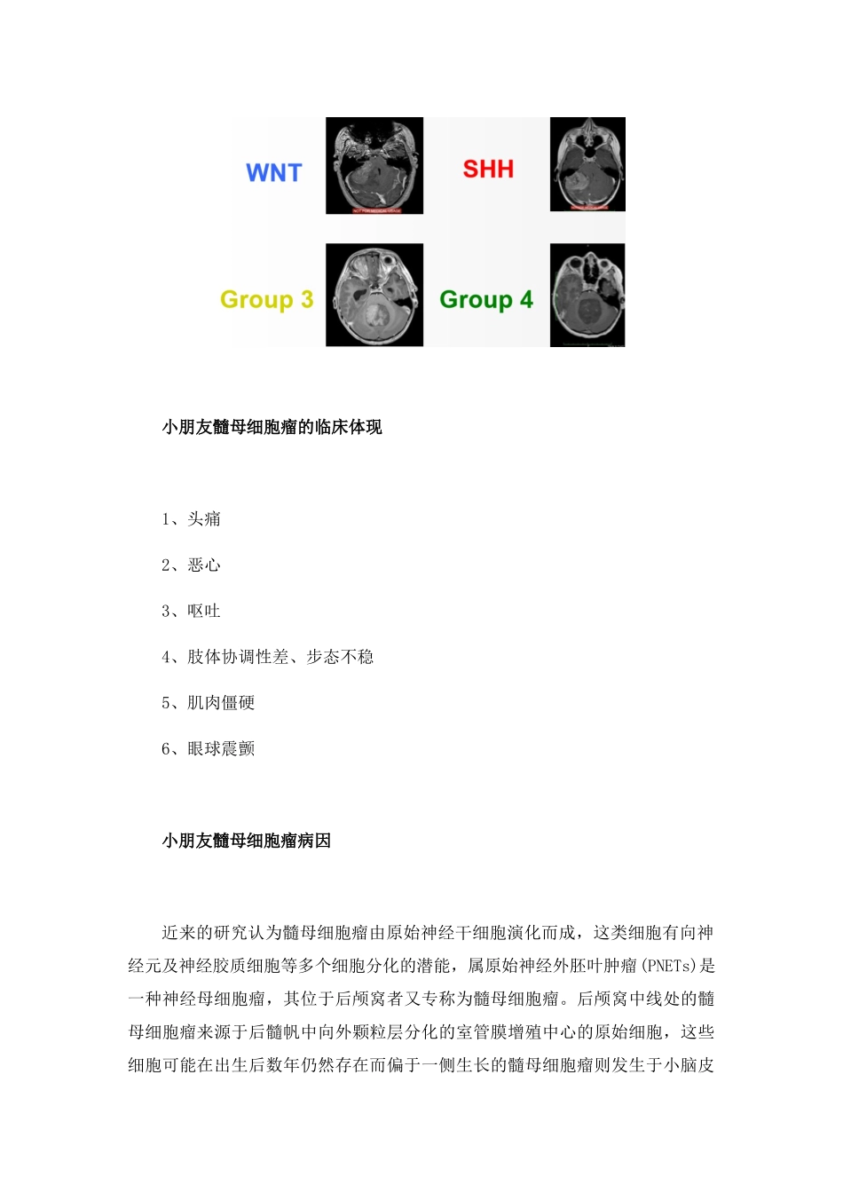 2025年髓母细胞瘤4种分子亚型及针对性治疗_第2页