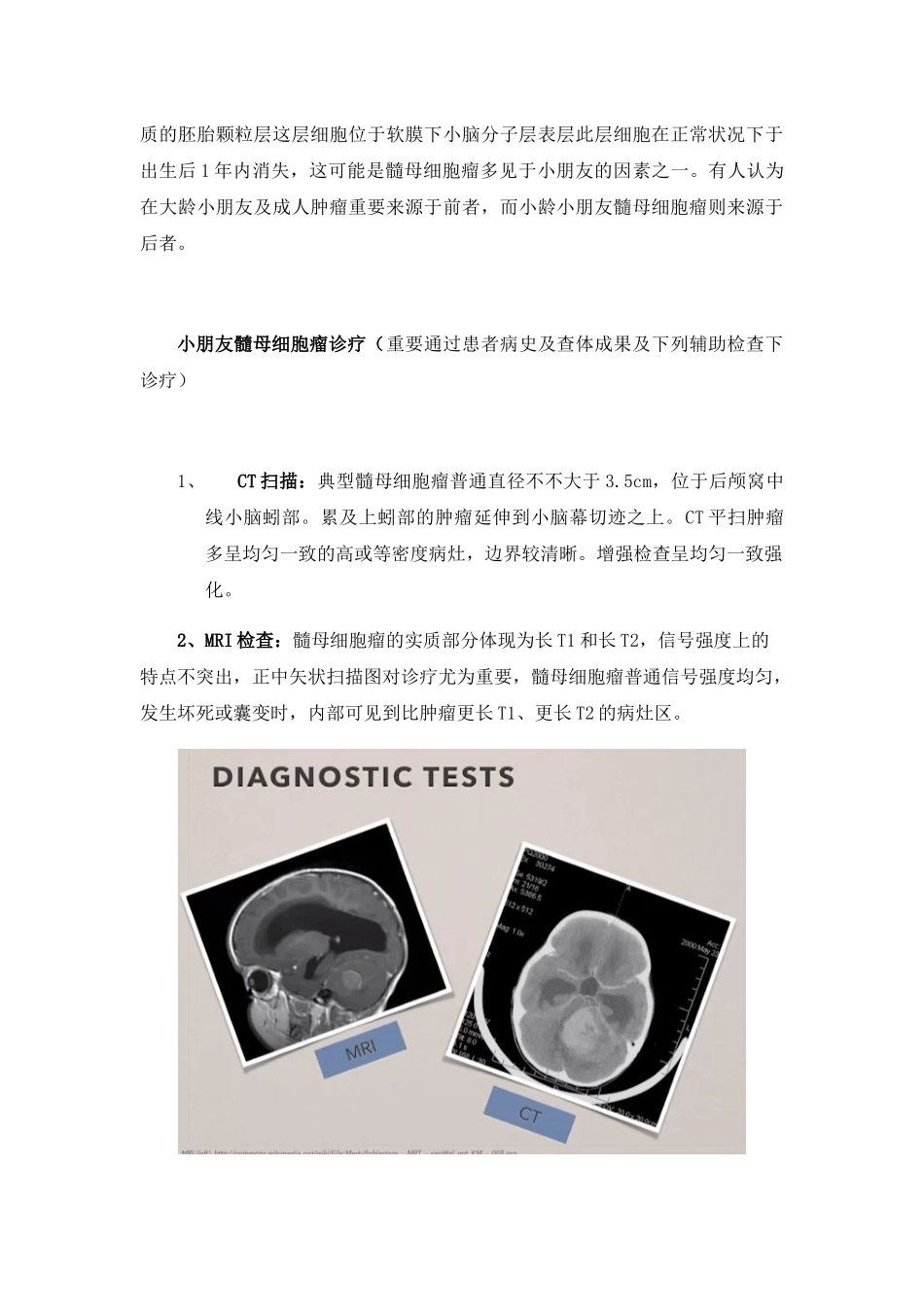 2025年髓母细胞瘤4种分子亚型及针对性治疗_第3页