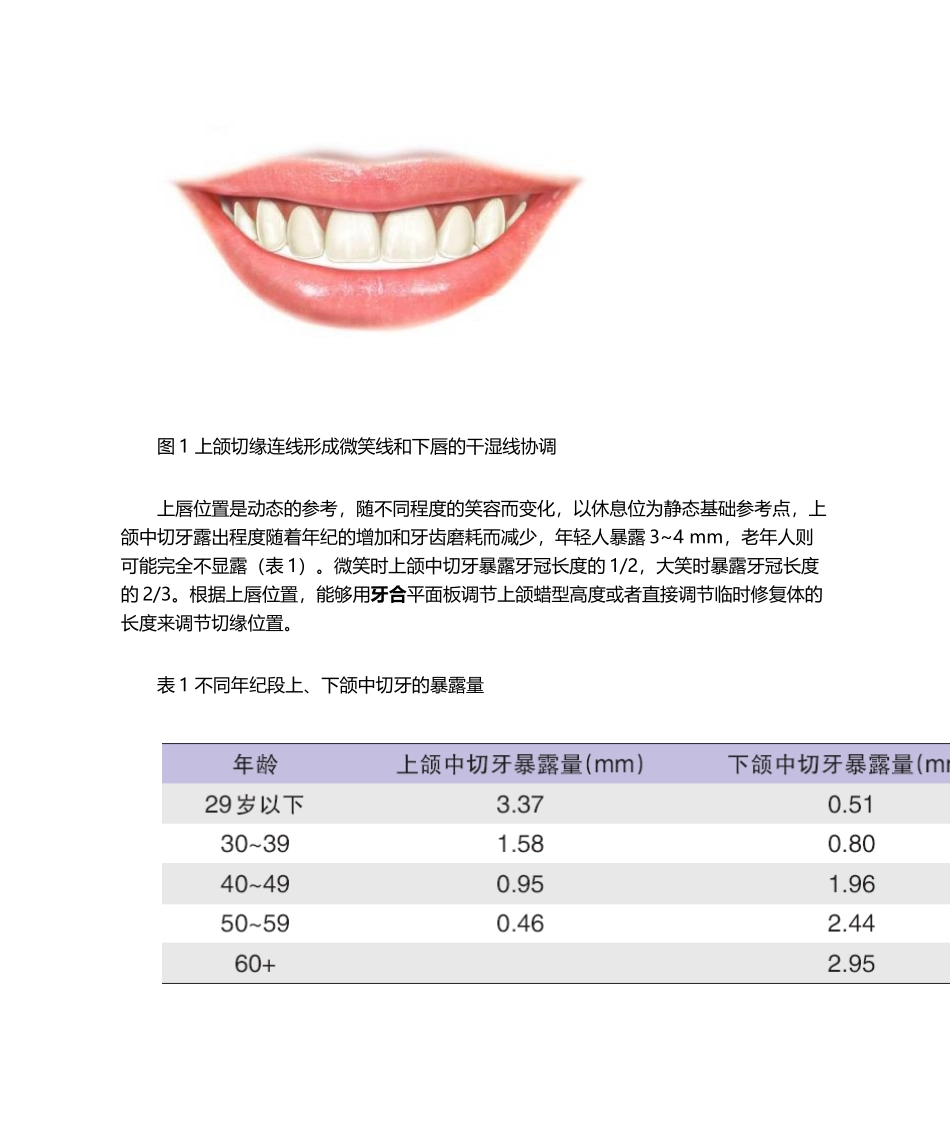 2025年如何确定前牙冠的长度和位置测试_第2页