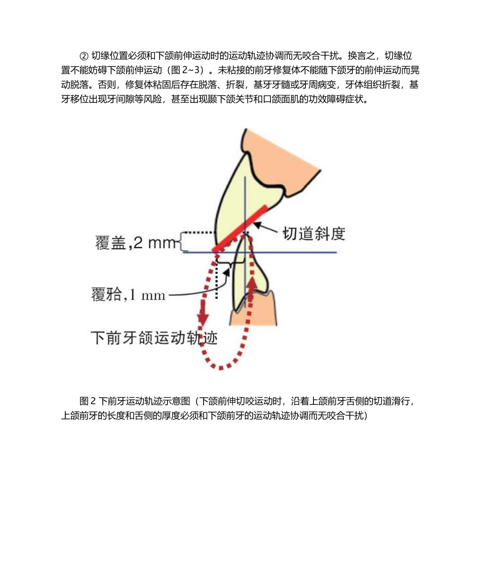 2025年如何确定前牙冠的长度和位置测试_第3页