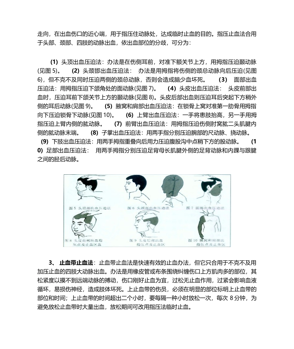 2025年止血和包扎方法介绍_第2页