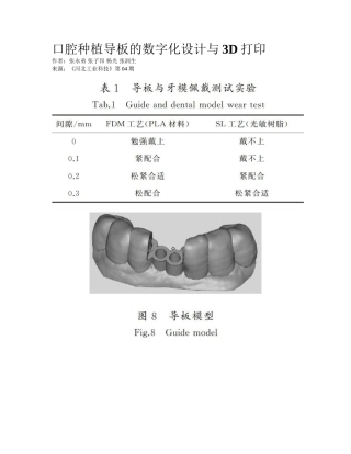 2025年口腔种植导板的数字化设计和三D打印