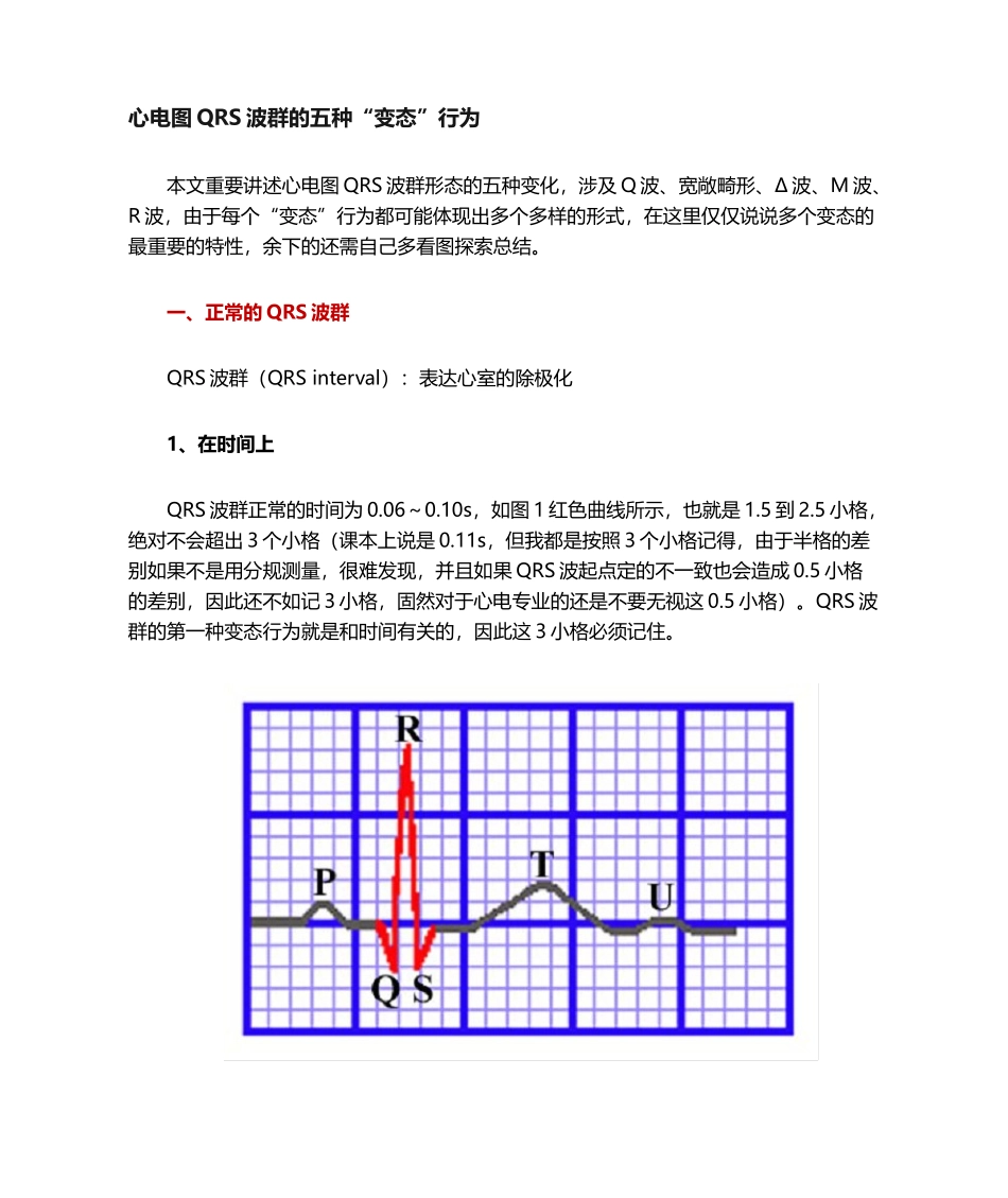 2025年心电图QRS波群的五种_第1页