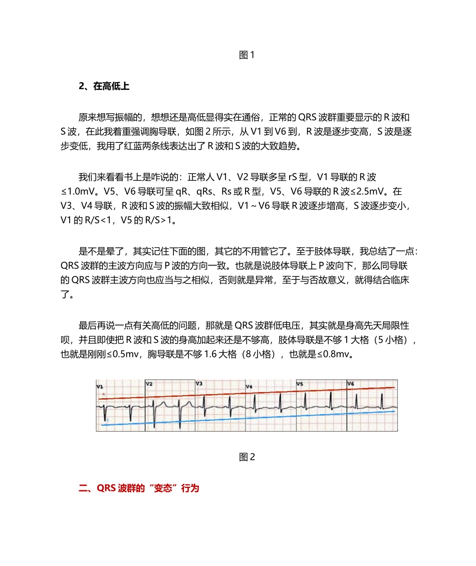 2025年心电图QRS波群的五种_第2页