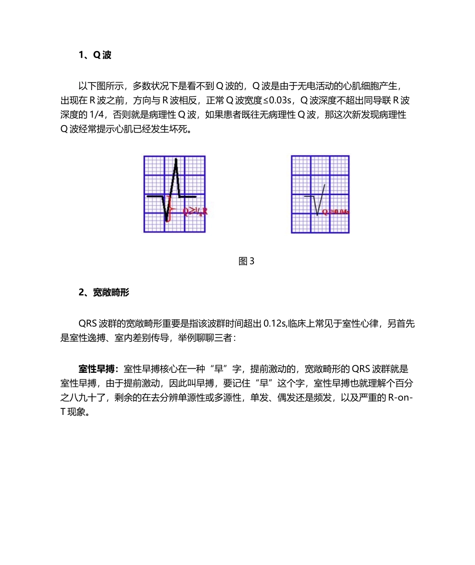 2025年心电图QRS波群的五种_第3页