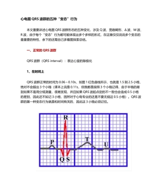 2025年心电图QRS波群的五种