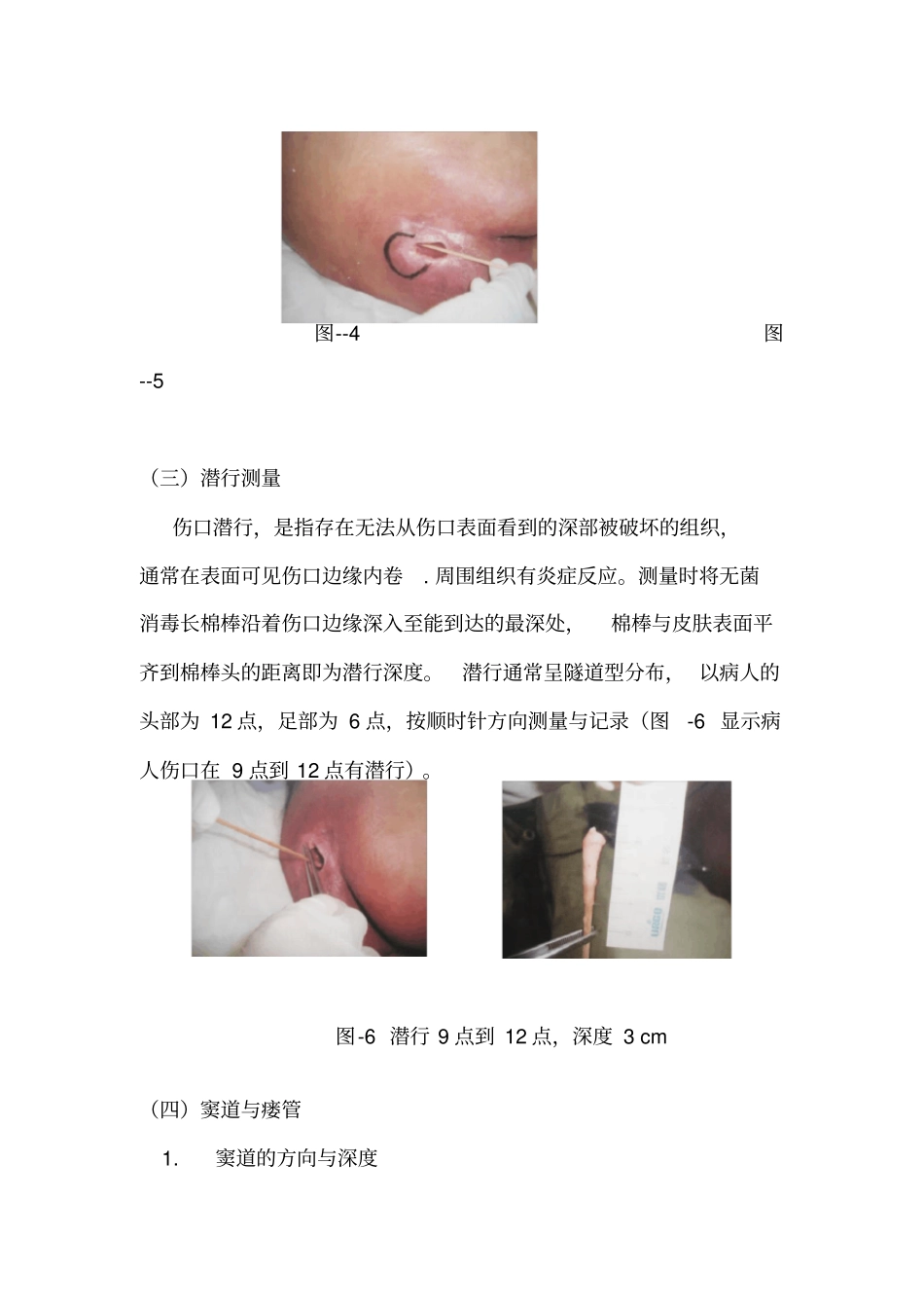 伤口测量解析_第2页