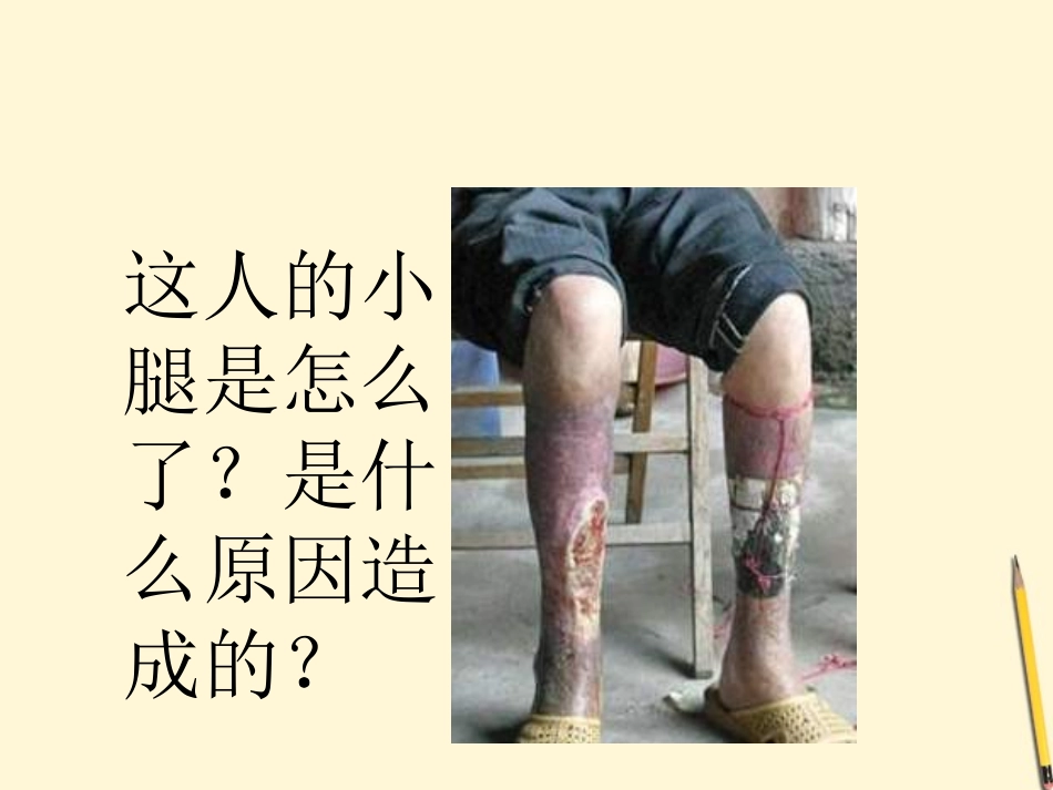 江西省萍乡四中八年级生物上册 第五单元细菌课件_第2页