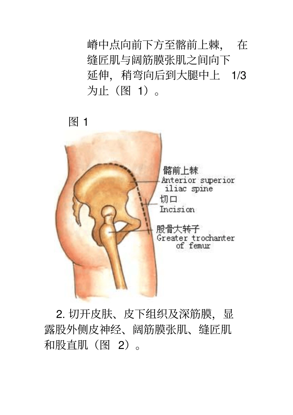 先天性髋关节脱位手术剖析_第2页