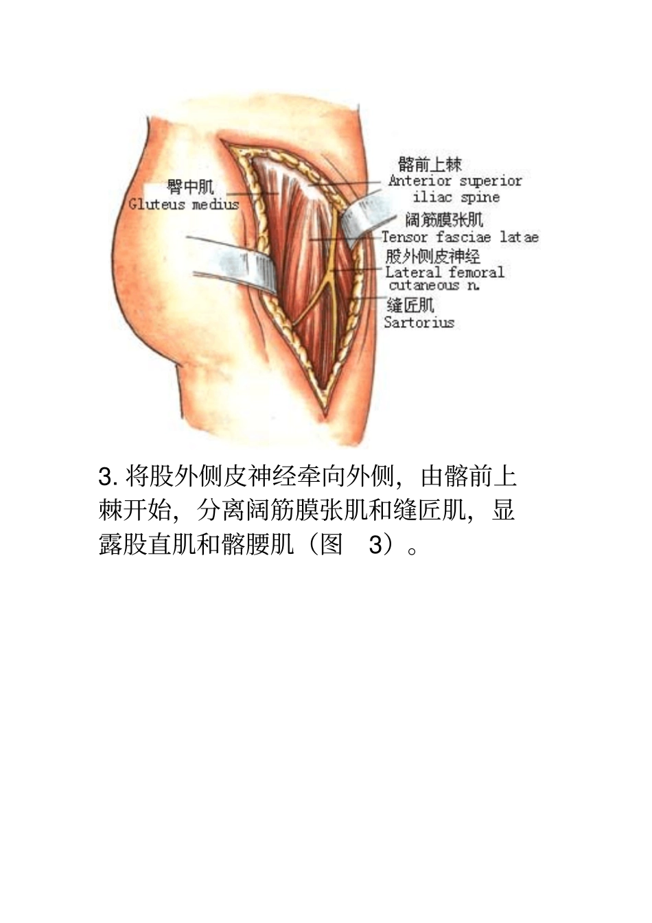 先天性髋关节脱位手术剖析_第3页