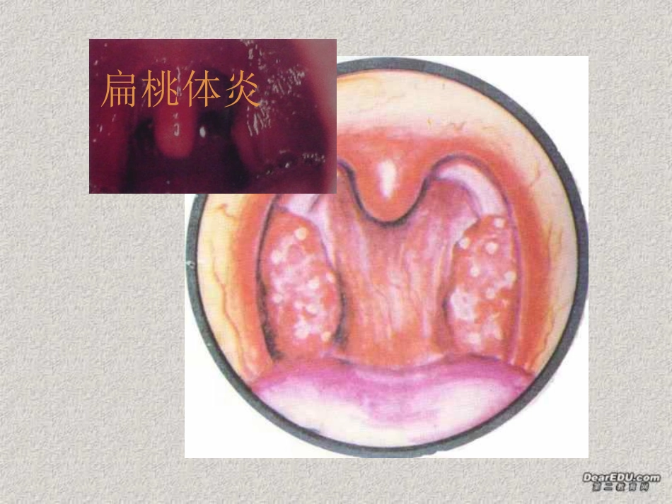 细菌和真菌在自然界中的作用八年级生物上册第五单元第五章第一节 课件_第2页